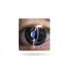 WADPP Handheld Slit Lamp 5X Portable Ophthalmoscope for Veterinary Use-2