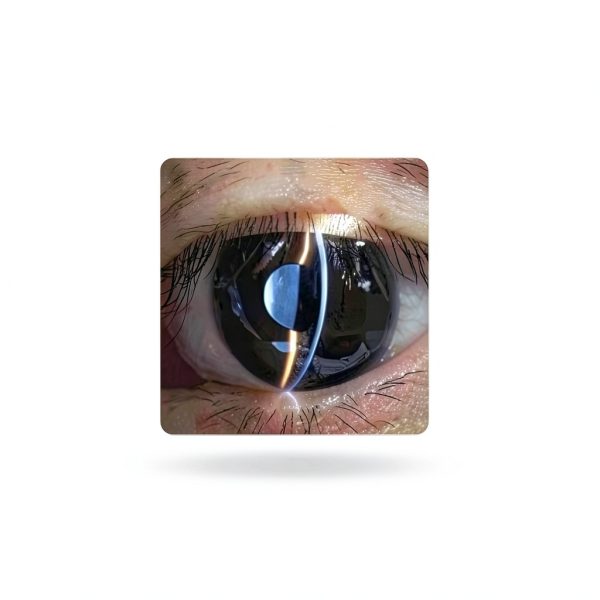 WADPP Handheld Slit Lamp 5X Portable Ophthalmoscope for Veterinary Use-2